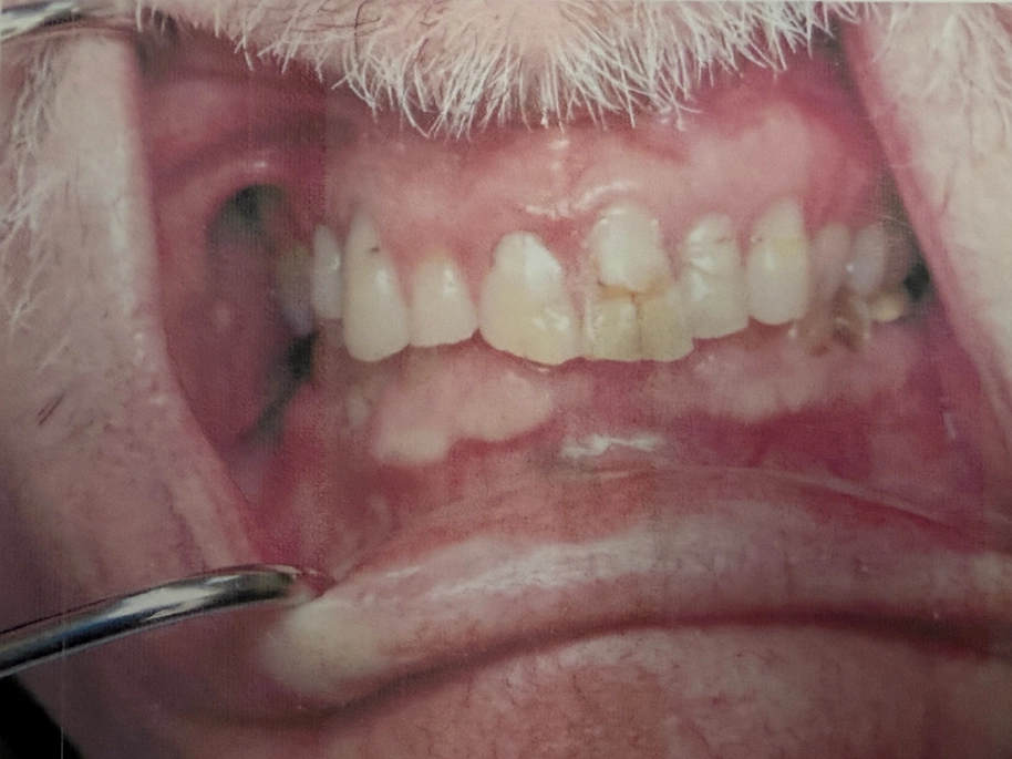 Before smile makeover